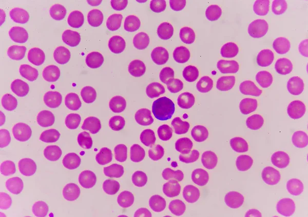 Normochrome normacytische rote Blutkörperchen — Stockfoto
