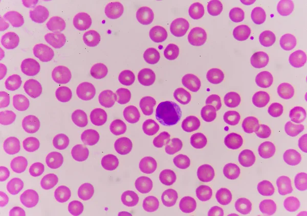 Normochromic normacytic red blood cells — Stock Photo, Image