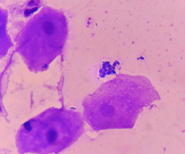 mayası ile pseudohyphae