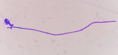 mayası ile pseudohyphae