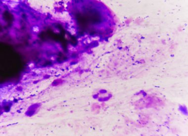 Gram boyama, de Gram'ın yöntemi denir