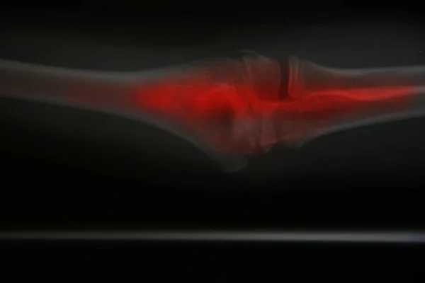 Close up joint  x-ray — Stock Photo, Image