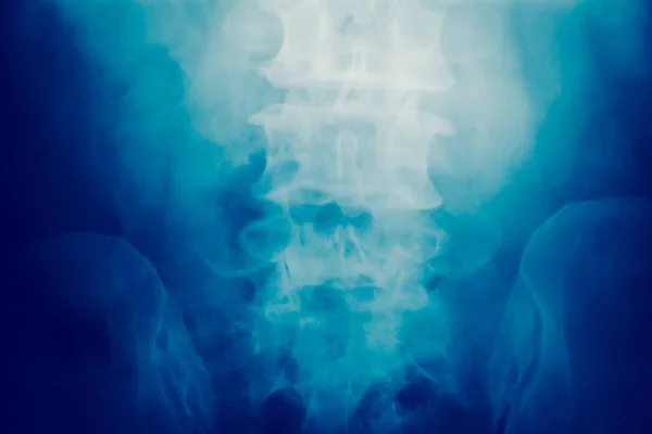 Chiudi l'osso del midollo spinale — Foto Stock