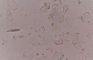 bakteri hücreleri Maya hücreleri ile epitel doku