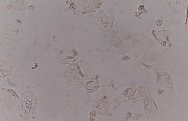 bakteri hücreleri Maya hücreleri ile epitel doku