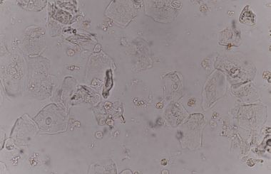 bakteri hücreleri Maya hücreleri ile epitel doku