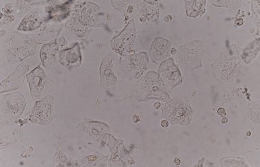 bakteri hücreleri Maya hücreleri ile epitel doku