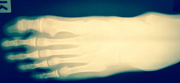 Kości stopy z bliska — Zdjęcie stockowe