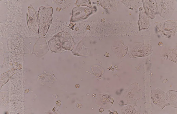 Tejido epitelial con células bacterianas células de levadura — Foto de Stock