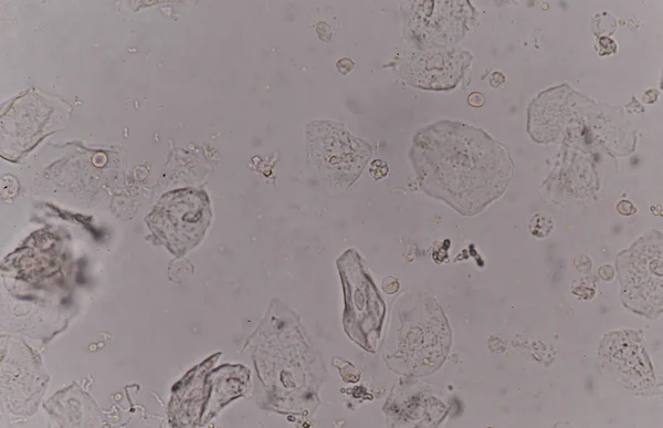 epithelial tissue with bacteria cells yeast cells