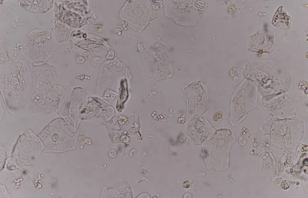 Tissu épithélial avec cellules bactériennes cellules de levure — Photo