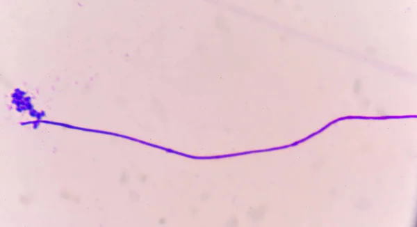 Células de levedura com tecido epitelial — Fotografia de Stock