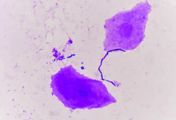 Células de levadura con tejido epitelial — Foto de Stock