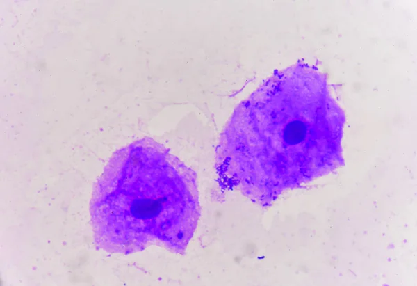 Yeast cells with epithelial tissue