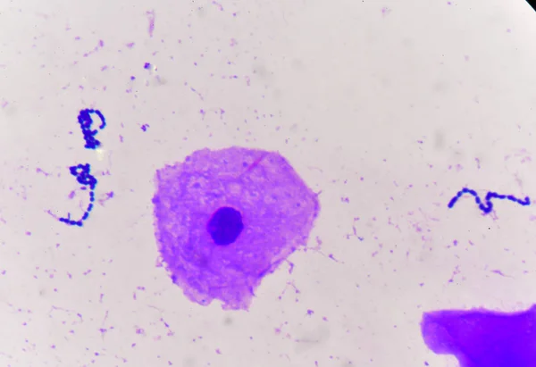Cellule di lievito con tessuto epiteliale — Foto Stock