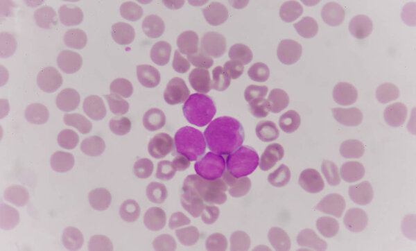 blood smear is often used as a follow-up test