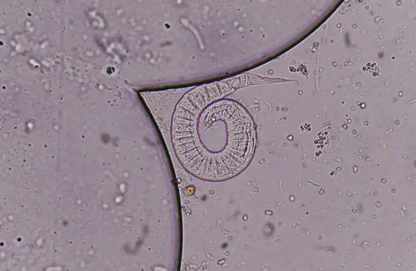 Strongyloides stercoralis (threadworm) στα κόπρανα, — Φωτογραφία Αρχείου