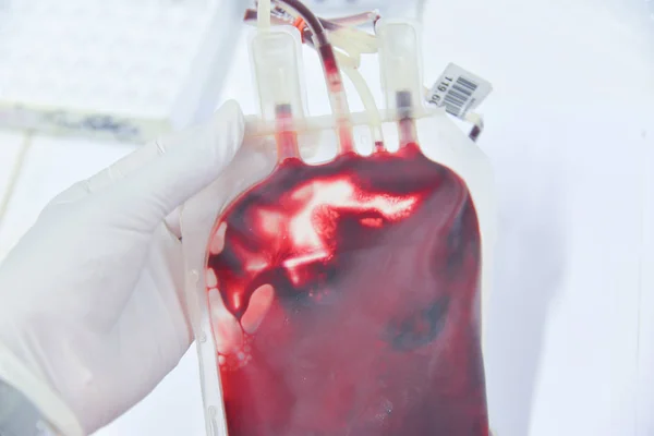 Blood in the blood bag for the patient — Stock Photo, Image