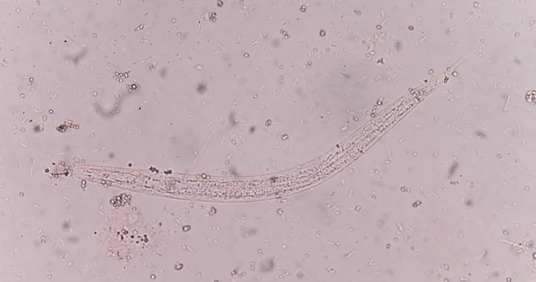 粪便中粪类圆线虫 (threadworm), — 图库照片