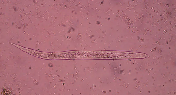 Strongyloides stercoralis (нитевидный червь) в стуле , — стоковое фото