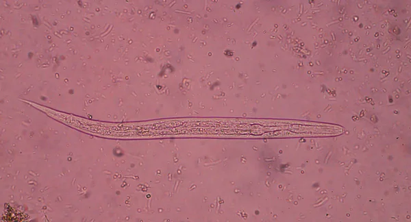 便中の線虫 (ぎょう), — ストック写真