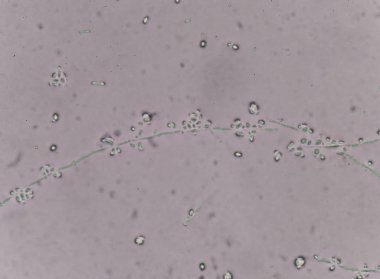 Maya hücreleri idrar örnekleri.