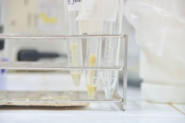 birkaç tüpleri ile raf 