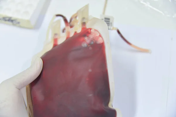 Bloed tas in laboratorium — Stockfoto