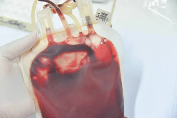 Blood bag in laboratory — Stock Photo, Image