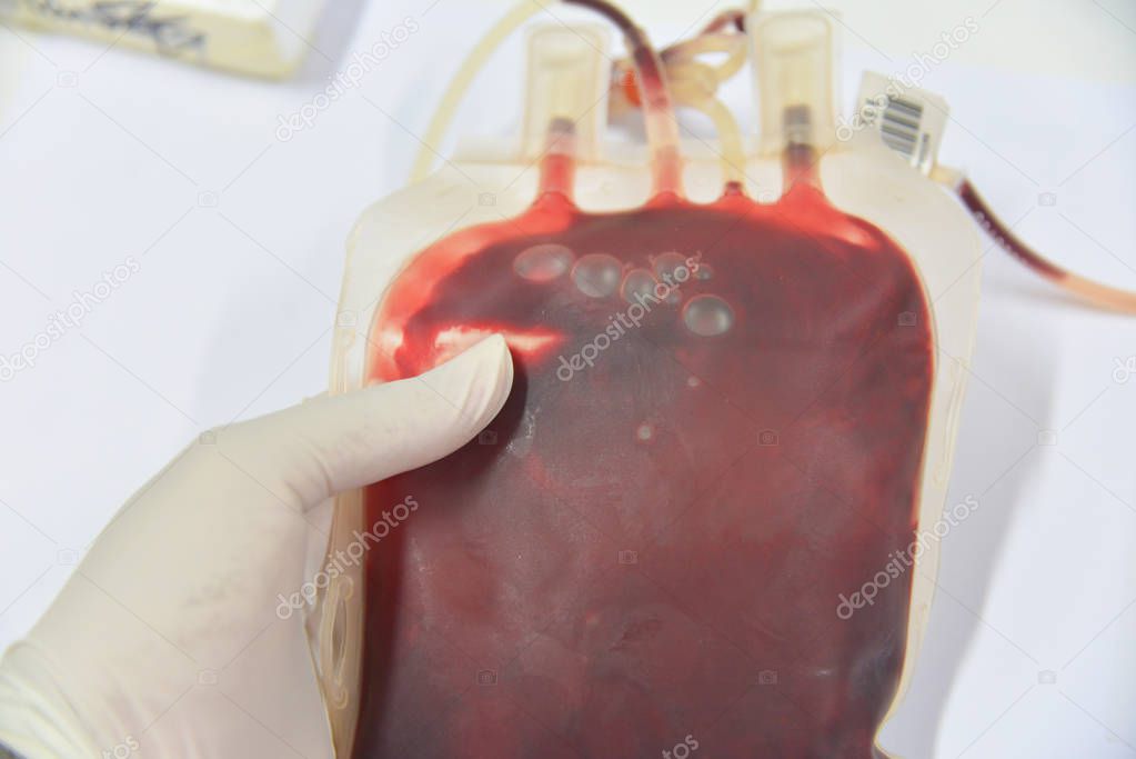 Blood bag in laboratory