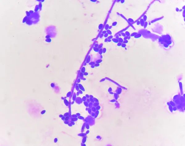 Budding yeast cells with pseudohyphae Gram stain method — Stock Photo, Image