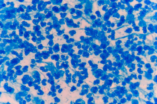 Mérsékelt kék fehérvérsejtek. — Stock Fotó
