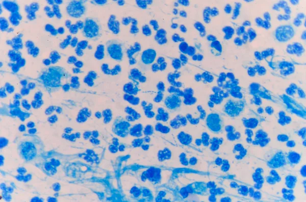 適度な青白血液細胞. — ストック写真