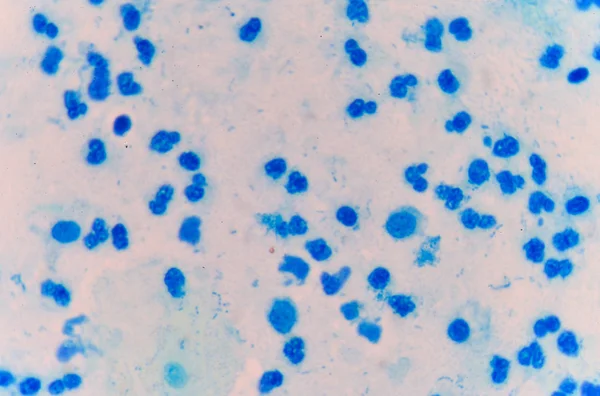 Mérsékelt kék fehérvérsejtek. — Stock Fotó