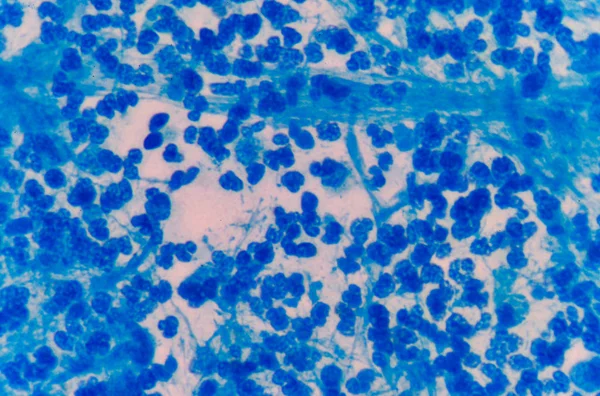 Måttlig blå vita blodkroppar. — Stockfoto