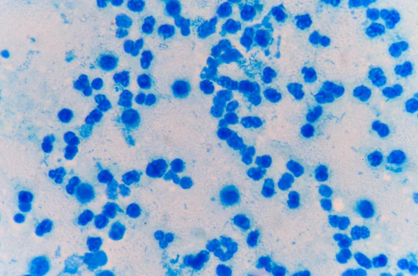 Globules blancs bleus modérés . — Photo