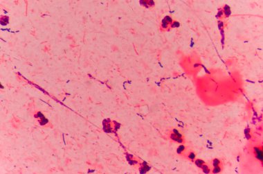 tıp biliminin arka plan.