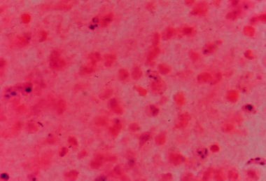 tıp biliminin arka plan.