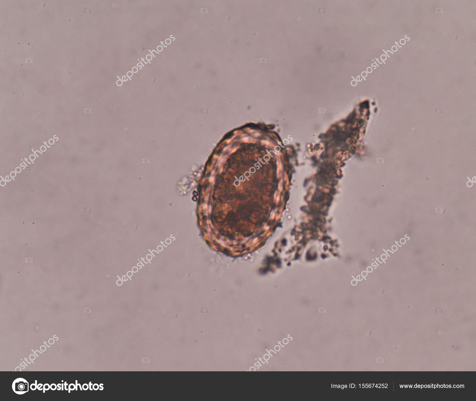 huevo ascaris lumbricoides