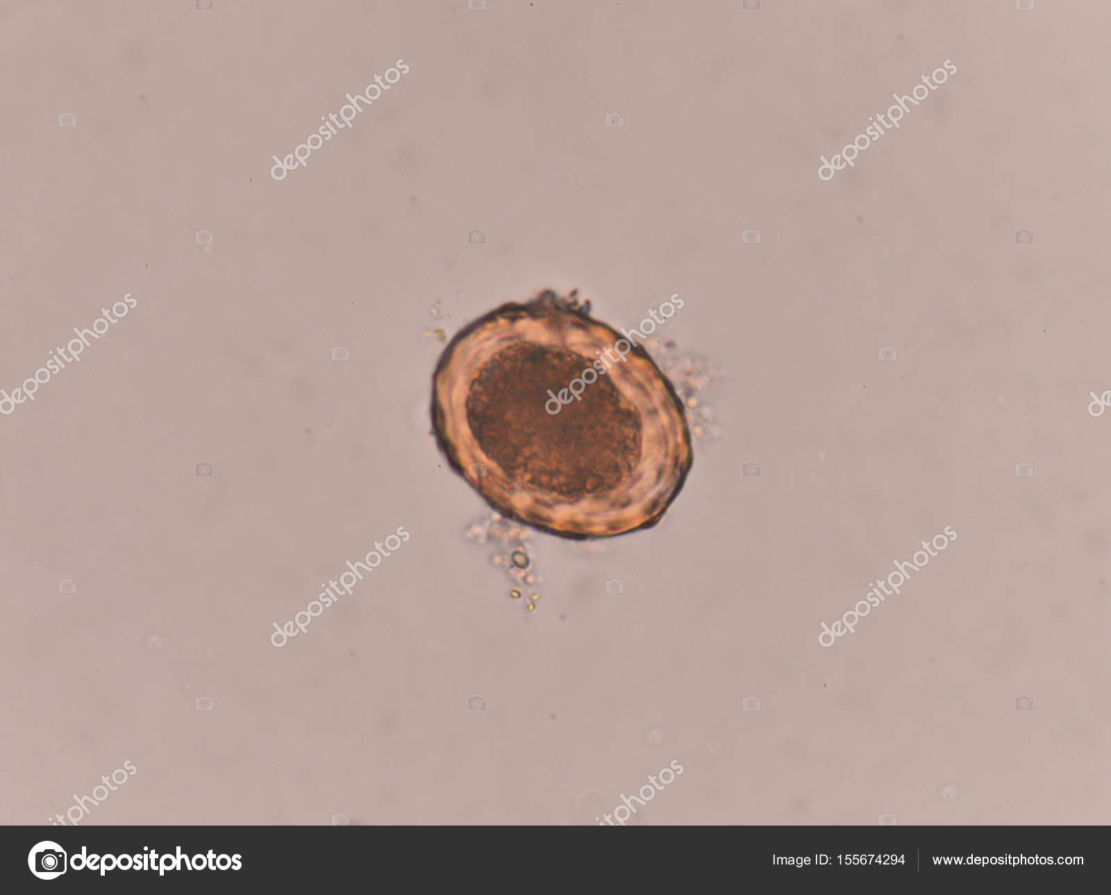 Ascaris Lumbricoides In Stool - Stools Item