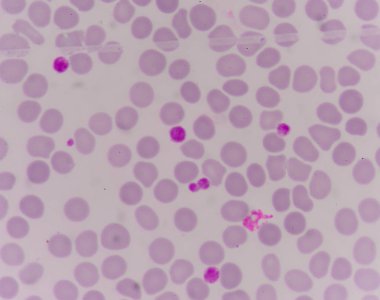 Kırmızı kan hücreleri üzerinde dev platlet