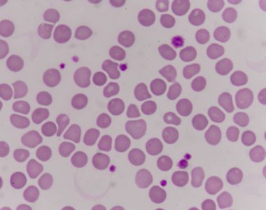 Kırmızı kan hücreleri üzerinde dev platlet