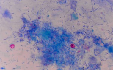 kırmızı hücreleri cryptosporidium oosit