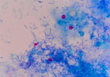 Cryptosporidium oosit mavi