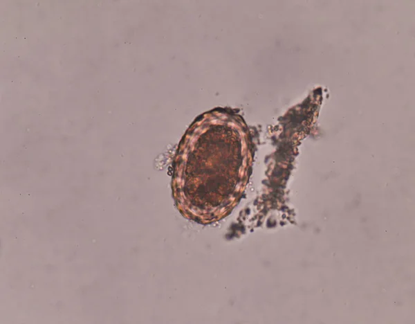 Ascaris lumbricoides huevo en el examen de heces . —  Fotos de Stock