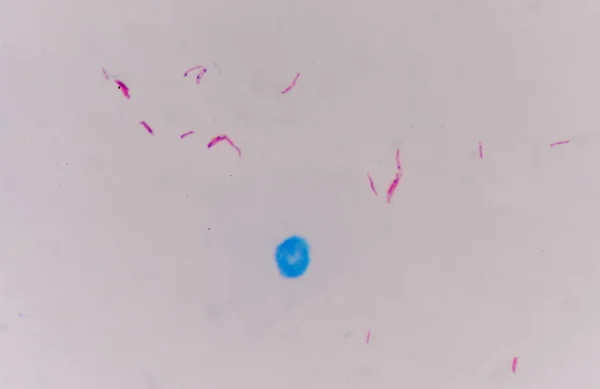 Mycrobacterium 결핵 레드 셀. — 스톡 사진