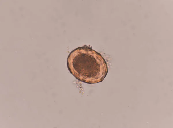 Ascaris lumbricoides egg in stool exam. — Stock Photo, Image