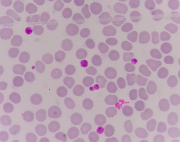 Kırmızı kan hücreleri üzerinde dev platlet — Stok fotoğraf