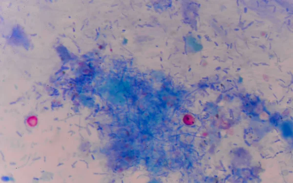 Krwinki czerwone cryptosporidium oocytów — Zdjęcie stockowe