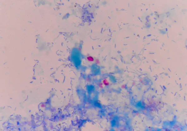 Oocito criptosporidium en azul — Foto de Stock